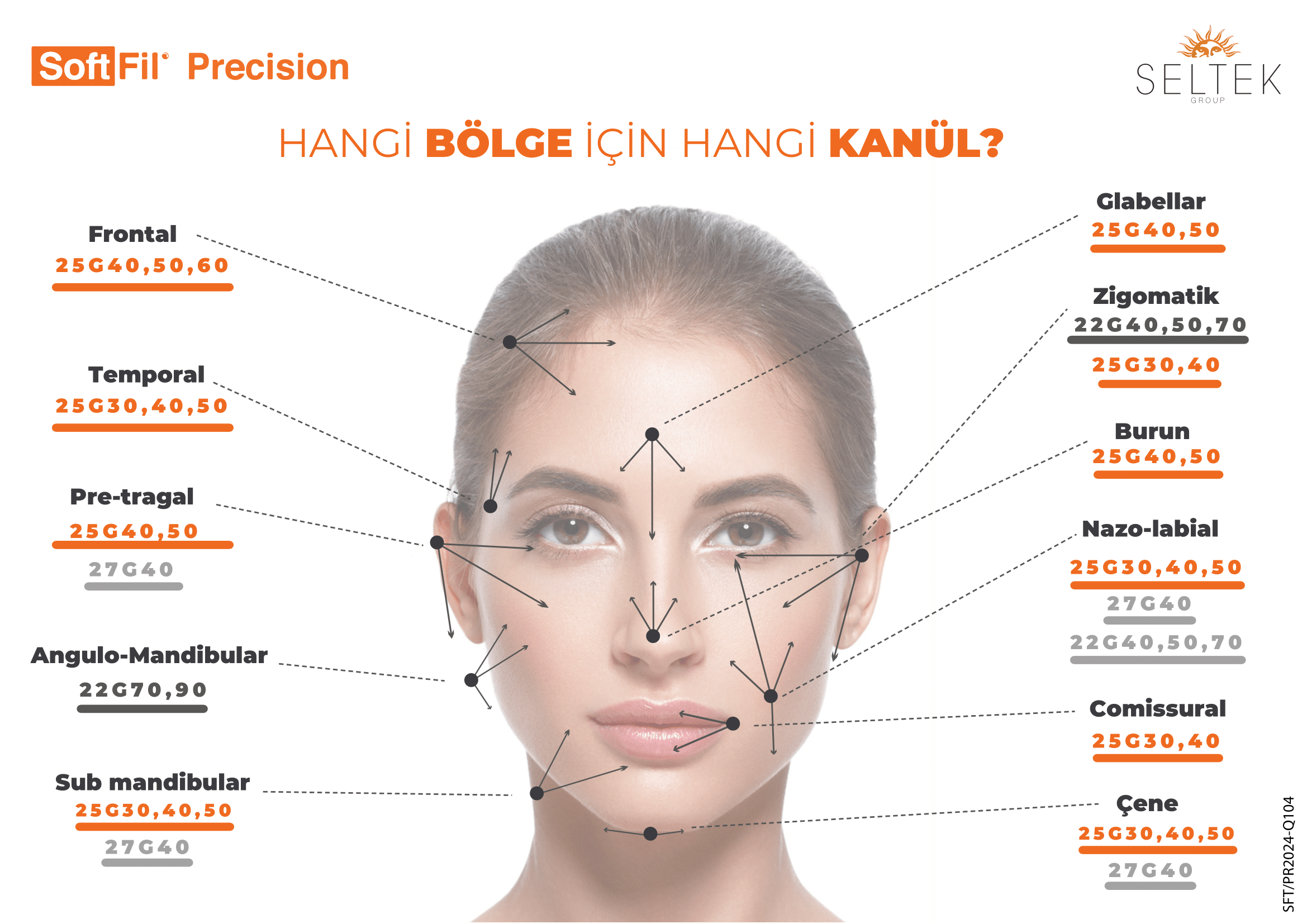 SoftFil Hangi bölge için hangi kanül? teknik bilgi görseli
